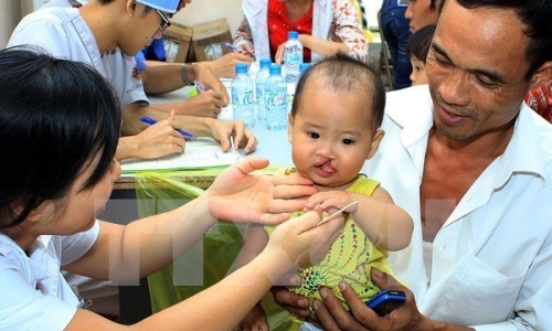 Bác sỹ Việt Nam-Hoa Kỳ thực hiện phẫu thuật chỉnh hình nhân đạo